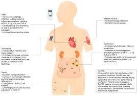 Diagram showing how sodium affects the body’s organs, including heart, kidneys, and muscles.